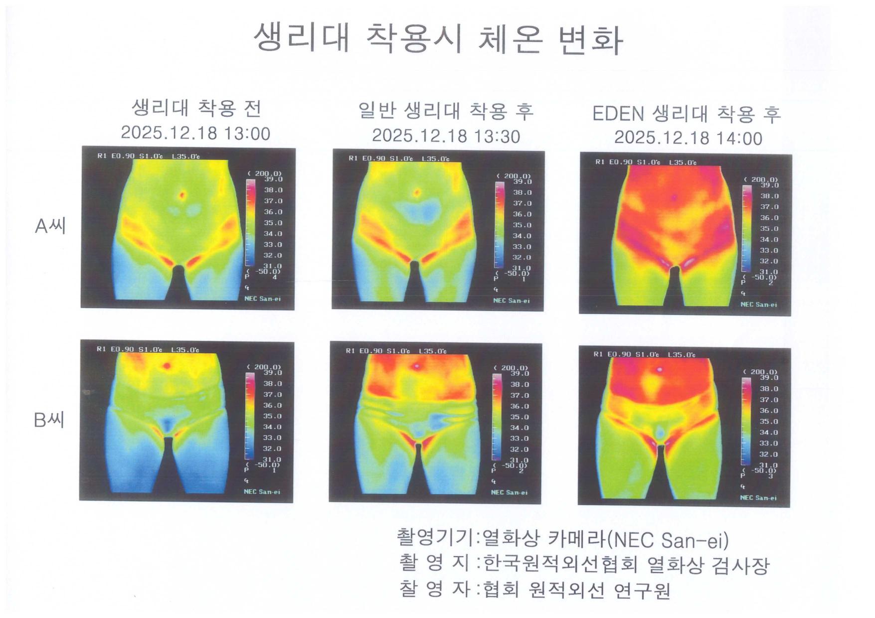 생리대 착용시 체온 변화 임상 열화상 카메라 시험 (가로 정방향)